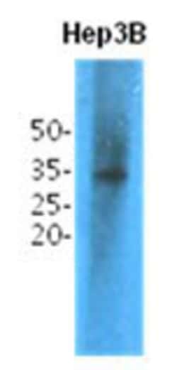TPMT Antibody (2E7) - BSA Free, Novus Biologicals 100&mu;L; Unlabeled:Antibodies,